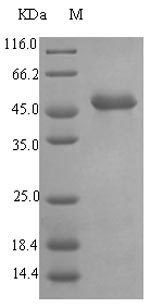 Recombinant Pseudomonas aeruginosa Elastase(lasB), 100ug