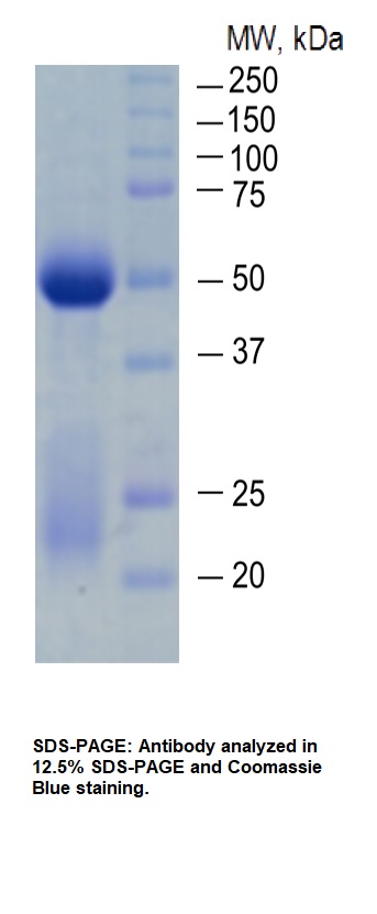 Anti-Dengue Virus Pan Serotype NS1 Antibody - 100 ug