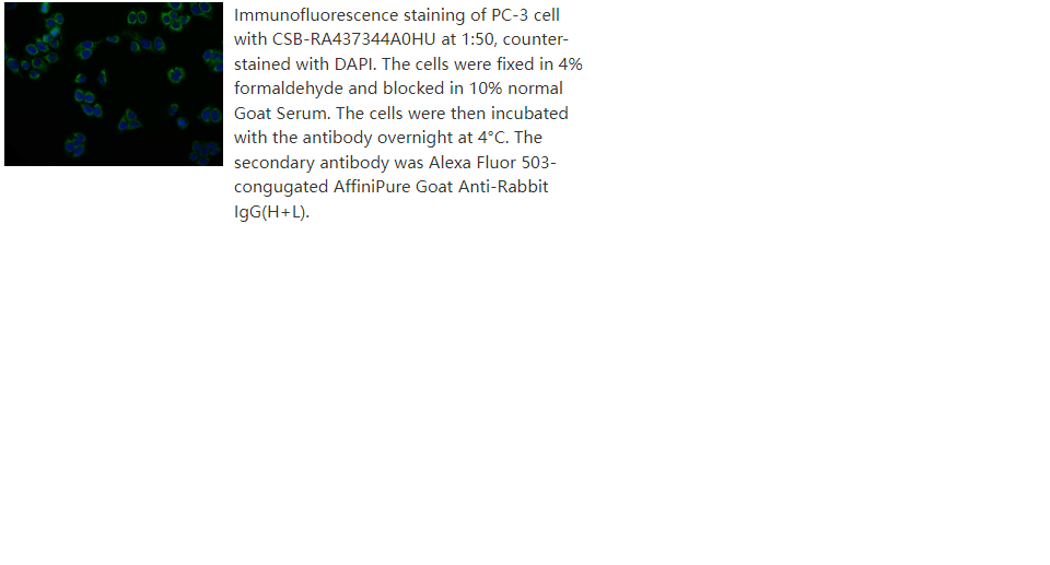 Human PRDX3 Recombinant Monoclonal Antibody [Clone: 14E2] - 100 ul