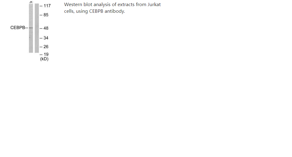 Rabbit anti-Homo sapiens (Human) CEBPB Polyclonal antibody - 100 uL