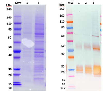 [0494-0506-015] Recombinant Angola marburgvirus Glycoprotein minus the Transmembrane Region (MARV-Angola rGPΔTM) - 100 ug