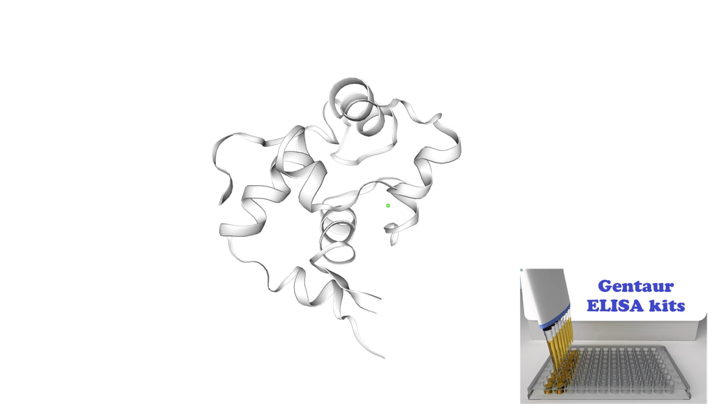 [0820-ELI-02011h] Human Troponin I, fast skeletal muscle (TNNI2) ELISA kit - 96 wells plate