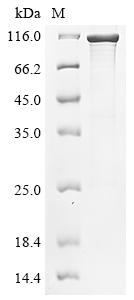 [0399-CSB-EP673803BUA(A5)-3MG] Recombinant Bordetella Pertussis brkA Protein (aa 1-1010), E. coli expression - 3 MG