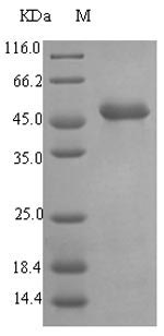 [0399-CSB-EP318584EZX-03] Recombinant Pseudomonas aeruginosa Elastase (lasB) - 1 mg