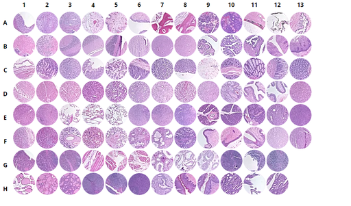 [0313-MNO1021] Normal human tissues, FDA, 35 organs in triplicates (1.5mm)