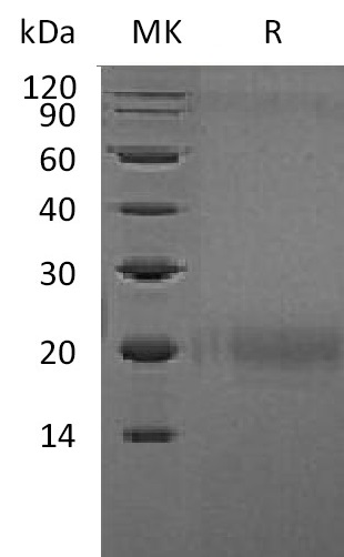 [0004-CS47-50UG] Recombinant Human CTLA-4 (C-Flag) - 50 ug