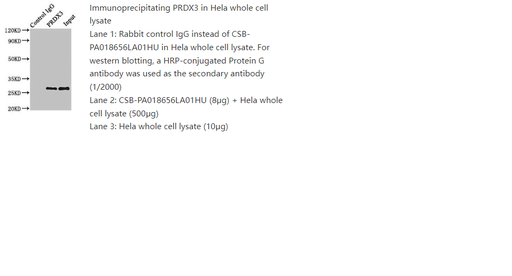 [0399-CSB-PA018656LA01HU-100UG] anti-PRDX3 (Human) Polyclonal antibody - 100 ug
